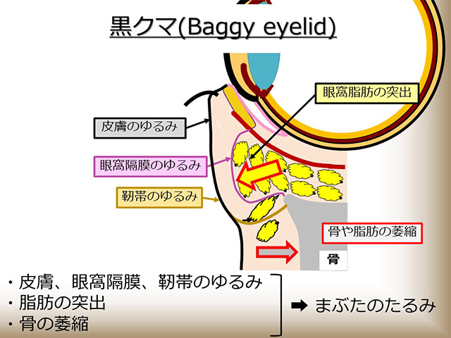 黒クマ