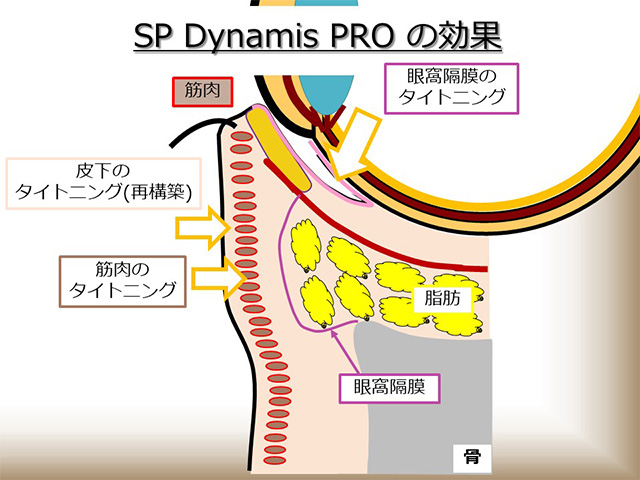 SP Dynamis PROの効果