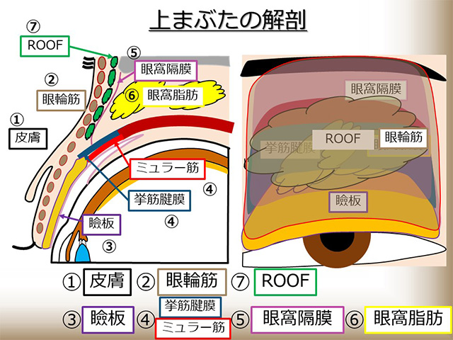 まぶたのくぼみとは