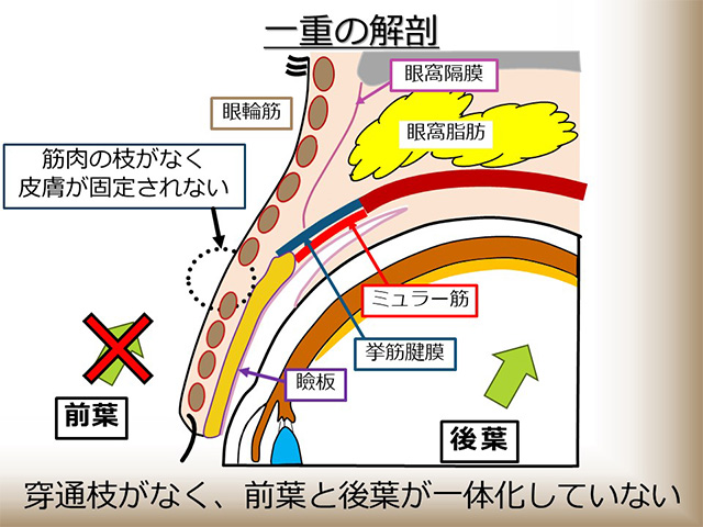 一重の解剖