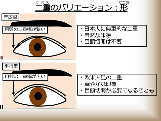 二重のバリエーション：形