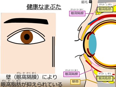 健康なまぶた