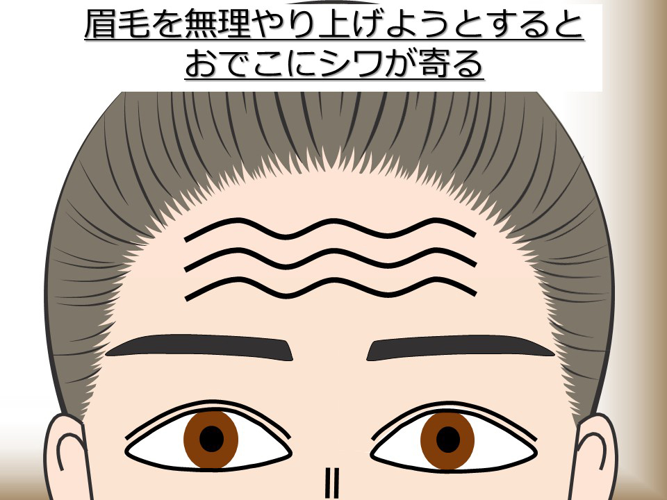 おでこにシワが寄る