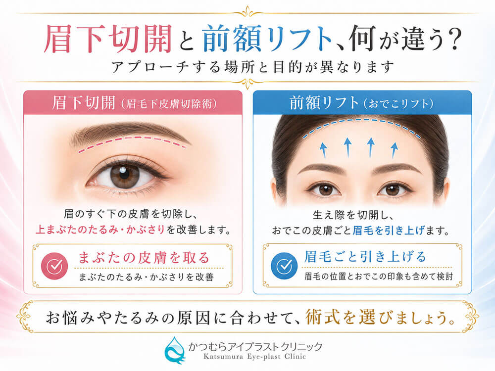 眉下切開と前額リフトではアプローチする場所と目的が異なります