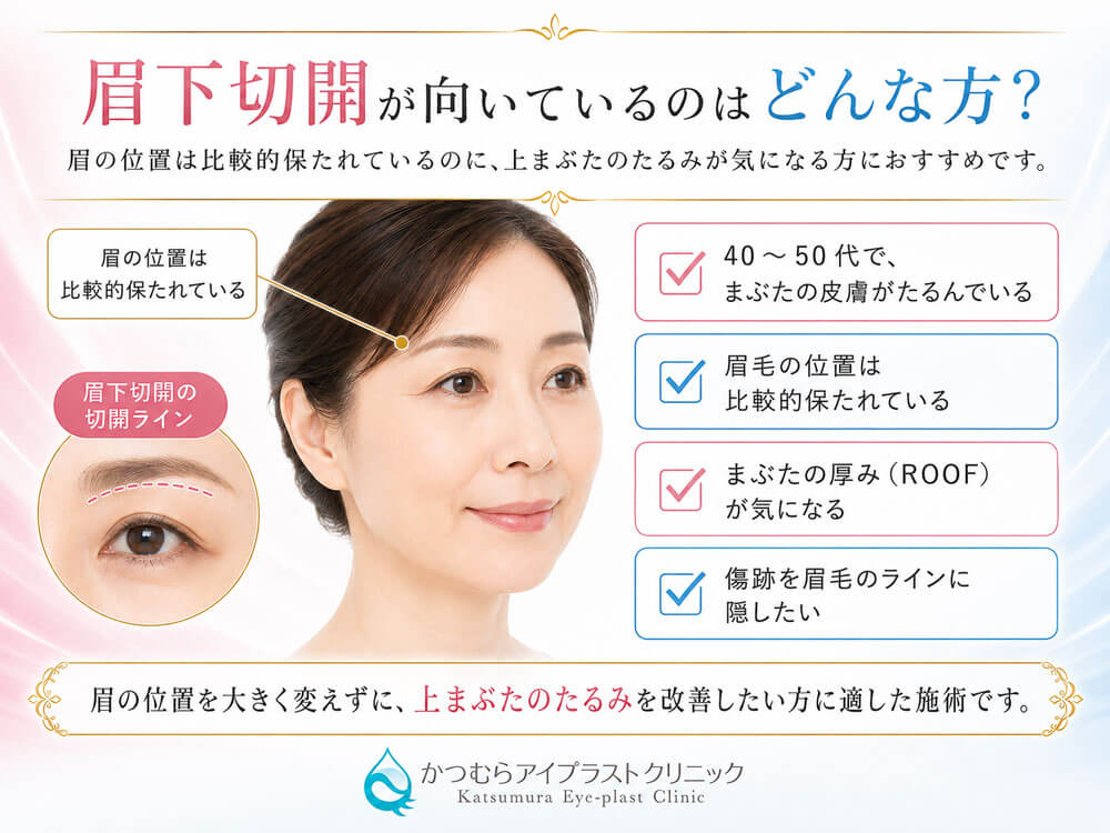 眉の位置を大きく変えずに上まぶたのたるみを改善したい方に適した施術です