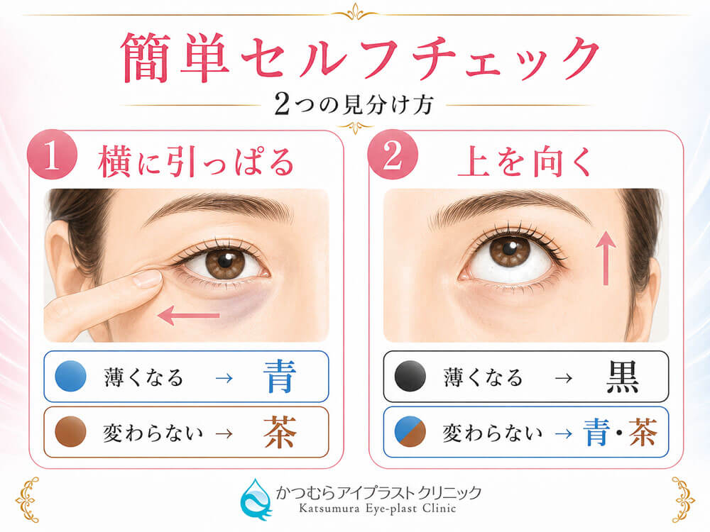 簡単セルフチェック