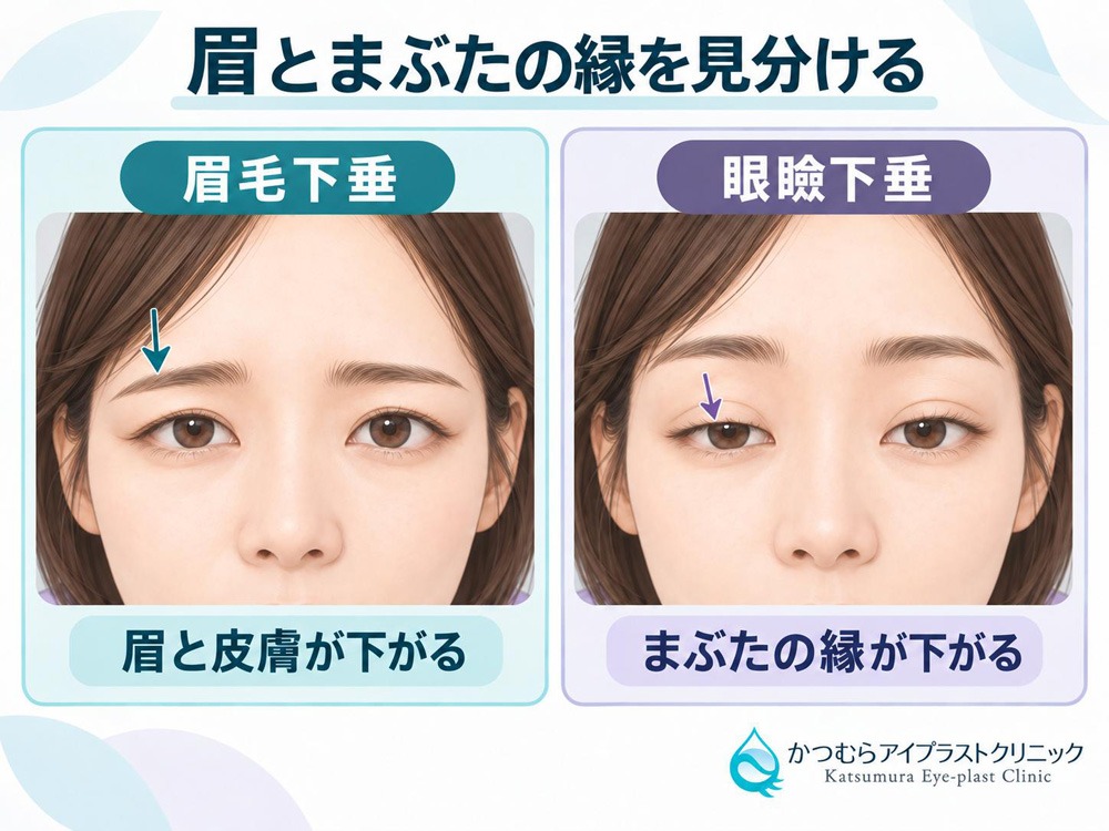 眉とまぶたの縁を見分ける