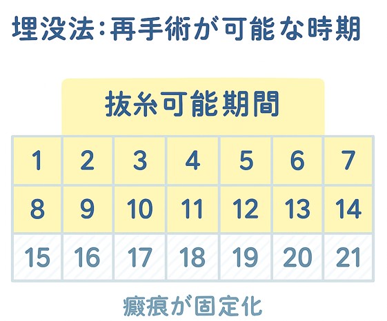 埋没法：再手術が可能な時期
