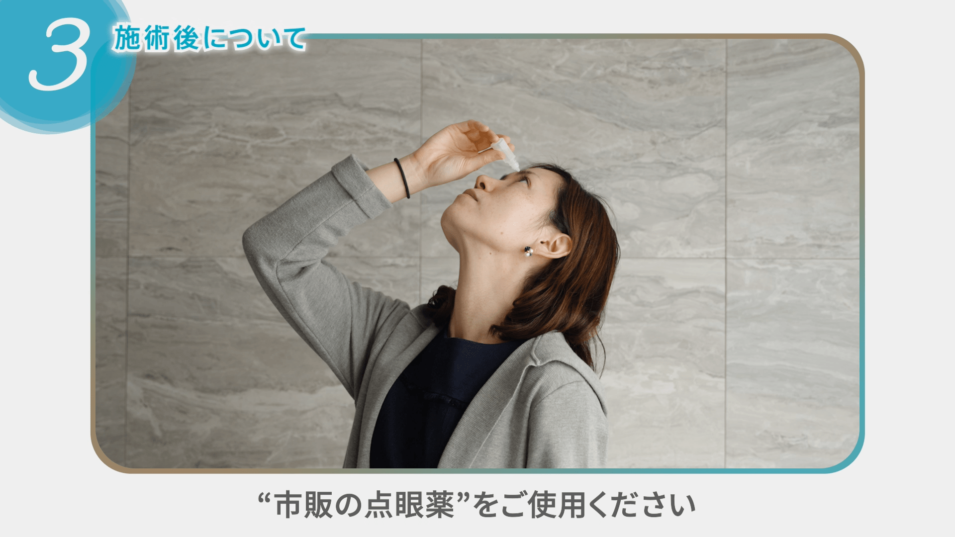 【解説動画:レーザーによる目もとのたるみ治療を受ける方に必ず伝える】術前後の3つのポイント - 【浦和の眼科】かつむらアイプラストクリニック ...