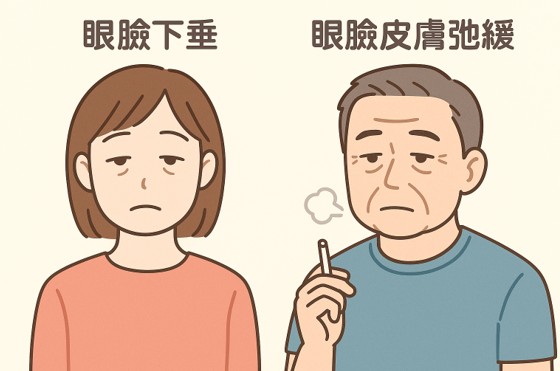 アジアでは女性、西洋では男性がなりやすい