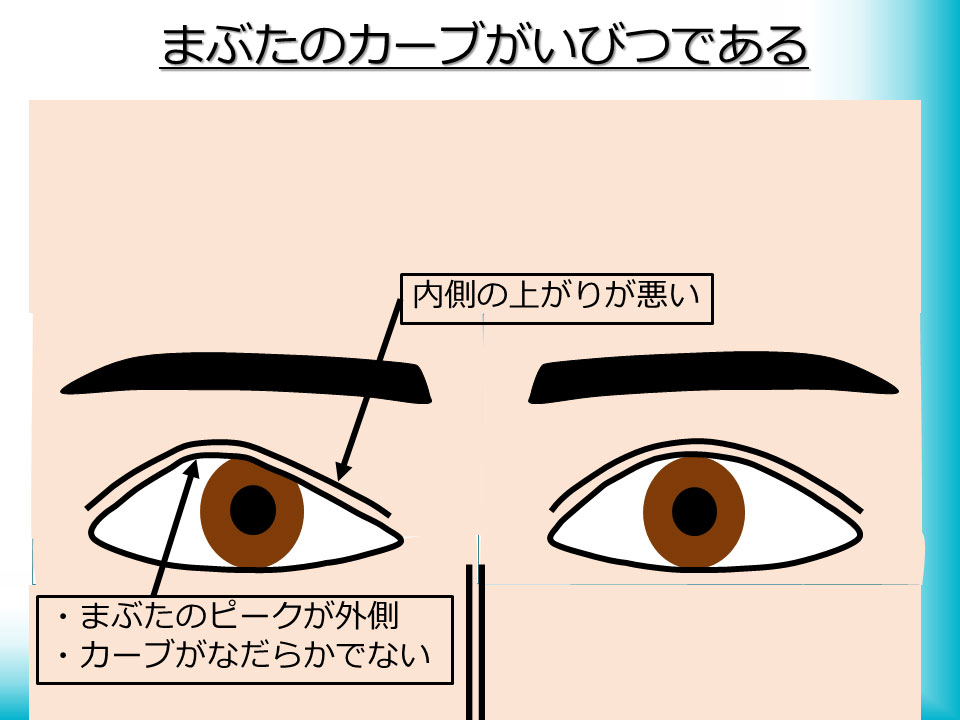 形態のばらつき