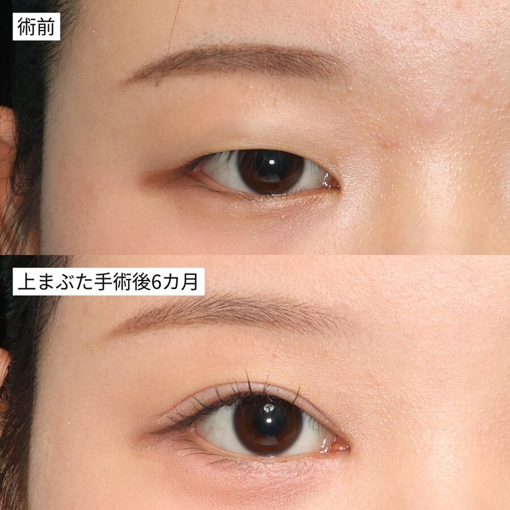 術後の経過