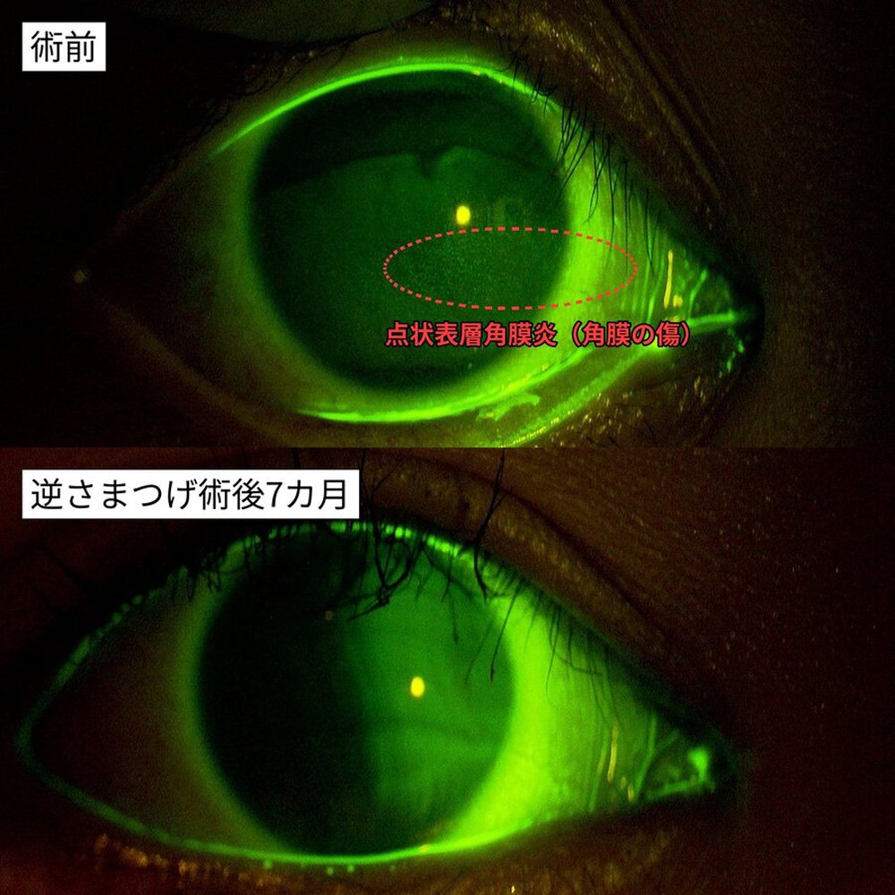 術後の経過